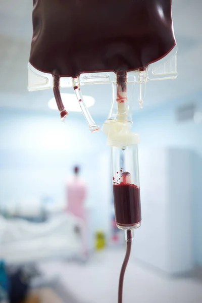 Krevní Transfuze Jip — Stock fotografie