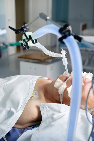 Intubated Erotische Blanke Man Onder Avl Ligt Coma Intensive Care — Stockfoto