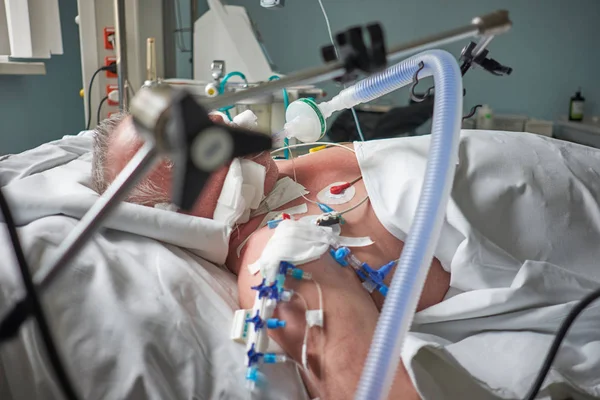 Intubated adult white man under ventilator lying in coma in inte — Stock Photo, Image