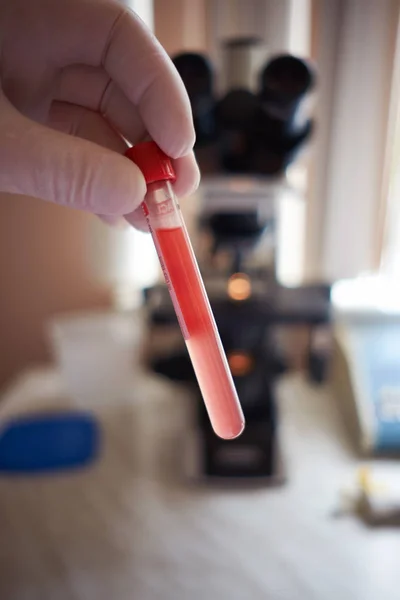 Con un tubo de ensayo lleno de sangre, diagnóstico de microscopio de sangre — Foto de Stock