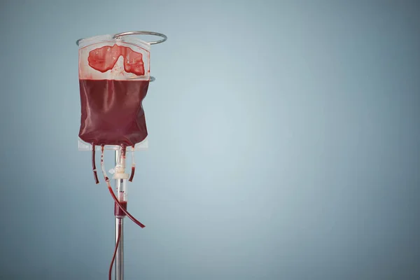 Transfusie van bloed, zak met rode bloedcellen op stand — Stockfoto