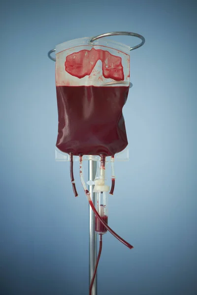 Bluttransfusion, Beutel mit roten Blutkörperchen im Stand. blau ba — Stockfoto