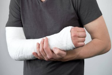Beyaz bir arka planda alçıdan yapılmış bir adamın el görüntüsü..