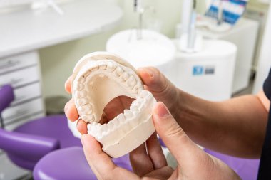 Gypsum model of jaw with teeth in in the hands of a dentist clipart