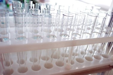 kan tüpleri ile raf