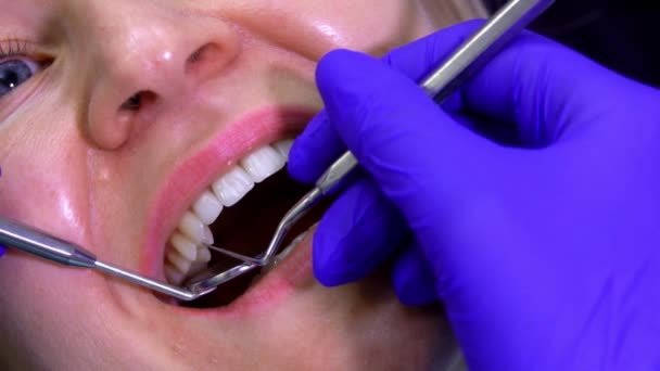 Primer plano del dentista examinando los dientes de un paciente — Vídeo de stock