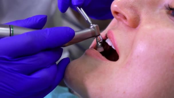 Dentista faz a escovação profissional dos dentes — Vídeo de Stock