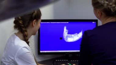 Diş hekimi çenenin 3d görüntü bakıyor