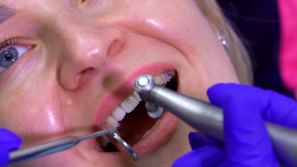 Zbliżenie dentysty dokonującego profesjonalnego czyszczenia zębów do pacjenta — Wideo stockowe
