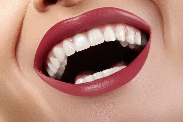 Macro Happy Female Smile Healthy White Teeth Bright Red Lips — Stock Photo, Image