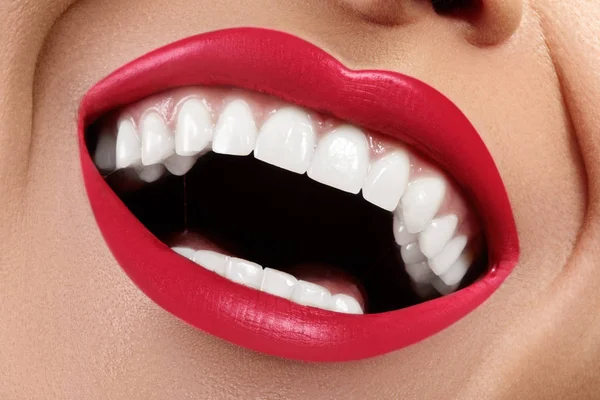 Sonrisa Femenina Feliz Macro Con Dientes Blancos Saludables Maquillaje Labios —  Fotos de Stock