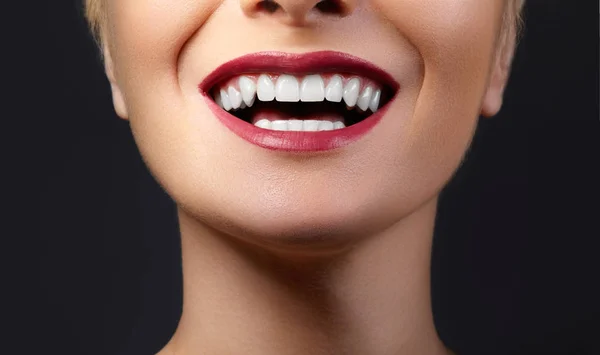 特写快乐女性微笑与健康洁白的牙齿 明亮的红色光泽嘴唇化妆 牙科和美容护理 女性微笑的嘴的宏观 — 图库照片