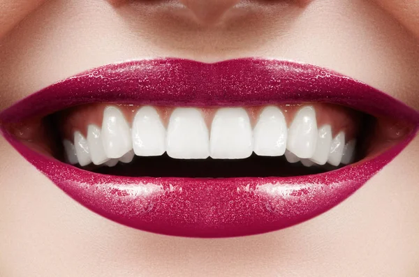 Beleza dentária. Macro bonito com dentes brancos perfeitos. Moda Lábios Maquiagem Vermelha. Branqueamento do dente, tratamento de bem-estar — Fotografia de Stock