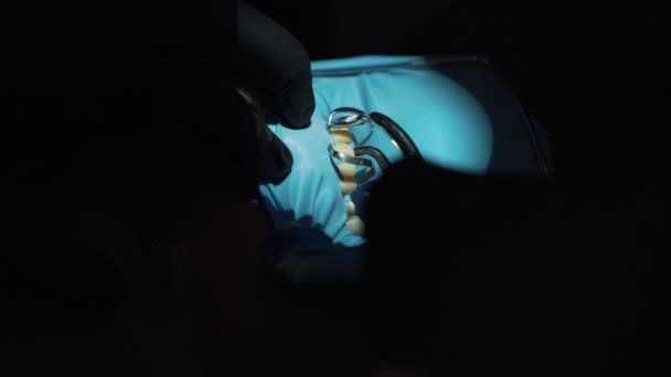 A dentist doing surgery close-up — Stock Video