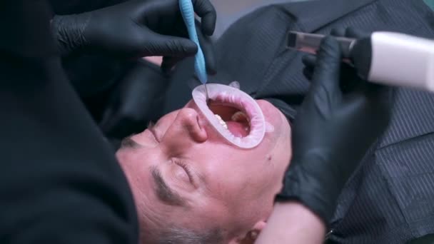Крупным планом стоматологическая операция для мужчины — стоковое видео