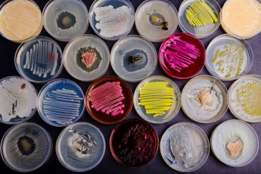 Çeşitli türde bakteri ve mantar içeren petri kapları.