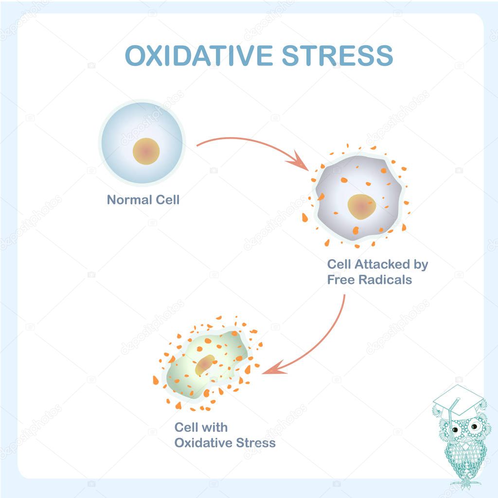 Oxidative stress scheme. Healthy cell caused by an attack of free radicals. Oxidative stress diagram stock vector illustration flat design for education