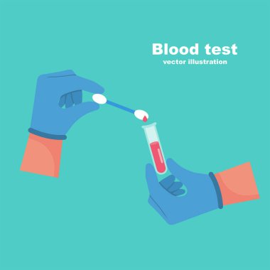 Doktor, kan örneğini test tüpünde tut..