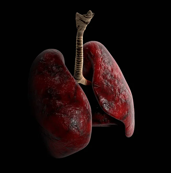 Anatomía pulmonar humana, Ilustración 3d sobre fondo negro — Foto de Stock