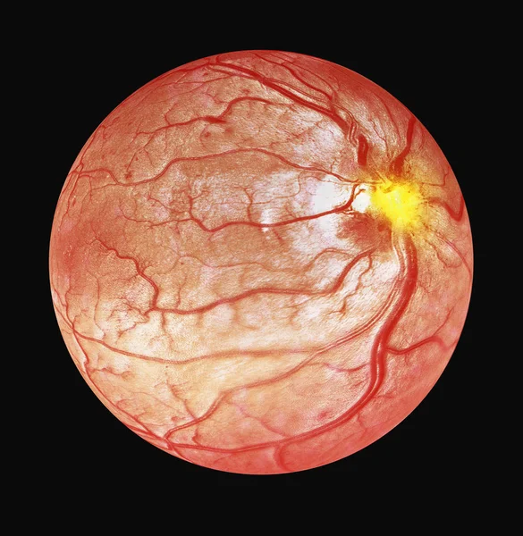 Illustration Optical Coherence Tomography Oct — Stock Photo, Image