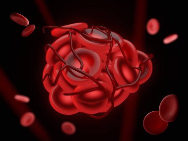 3d Illustration of illustration of a blood clot, thrombus or embolus with coagulated red blood cells. clipart