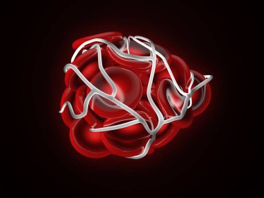 resimde bir kan pıhtısı, trombüsü veya emboli pıhtılaşmış kırmızı kan hücreleri ile 3D çizimi.