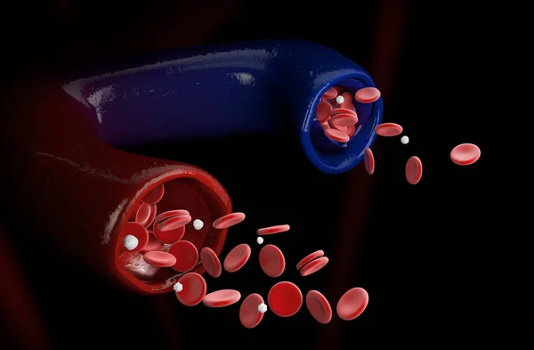 静脈瘤と通常静脈、下肢静脈瘤の 3 d イラストレーション — ストック写真