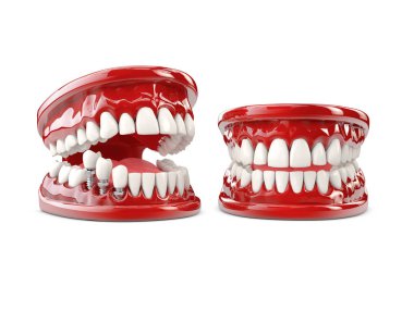 Diş insan implantı. Diş kavramı 3d illüstrasyon