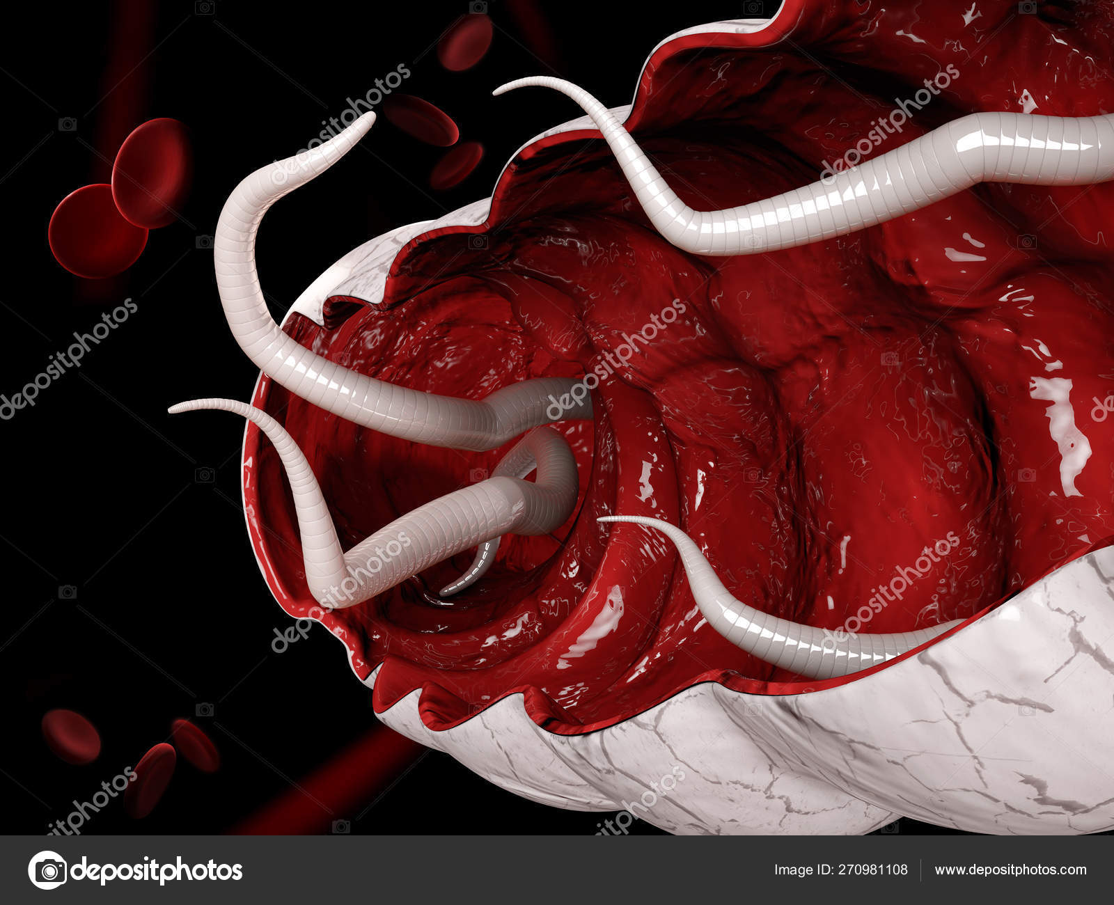 pictures of hookworms in humans pictures of hookworms in humans
