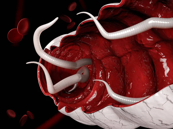 3d Illustrazione di un anchilostoma nell'intestino crasso — Foto Stock