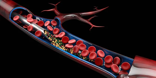 Ilustración 3d de la jeringa con vitamina y glóbulos rojos — Foto de Stock