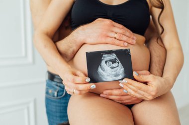 Mutlu bir evli çift ellerinde bebeğin ultrasonik bir çalışmasının fotoğrafını tutuyor..
