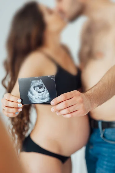 Ein glückliches Ehepaar hält einen Schnappschuss einer Ultraschalluntersuchung des Babys in den Händen. — Stockfoto