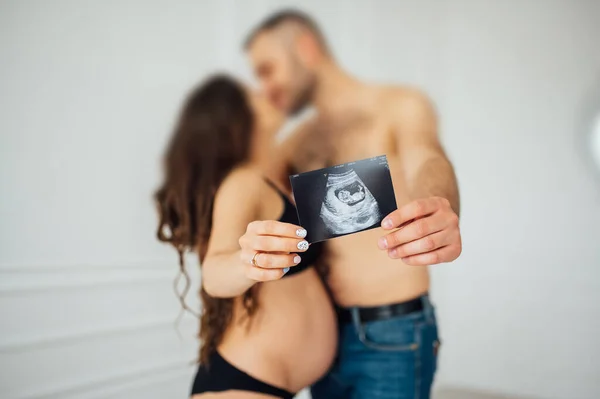 Una feliz pareja casada tiene en sus manos una instantánea de un estudio ultrasónico del bebé . —  Fotos de Stock