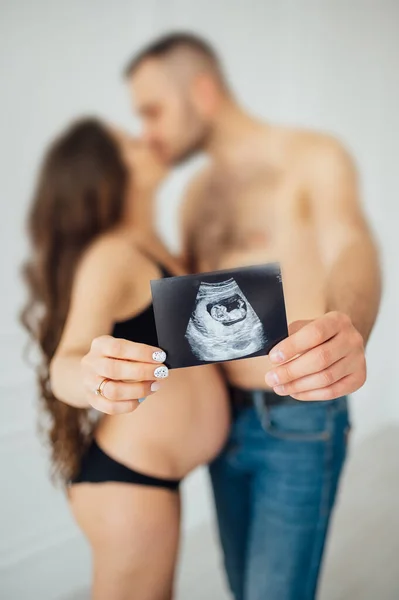 Ein glückliches Ehepaar hält einen Schnappschuss einer Ultraschalluntersuchung des Babys in den Händen. — Stockfoto