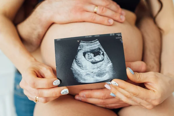 Um casal feliz está segurando em suas mãos um instantâneo de um estudo ultra-sônico do bebê . — Fotografia de Stock