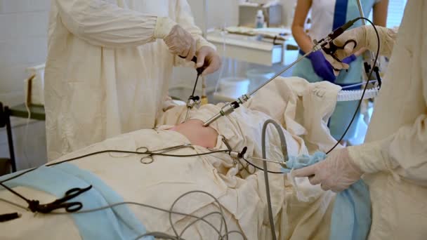 Vista da vicino dell'operazione di appendicectomia laparoscopica presso l'ospedale regionale per bambini — Video Stock