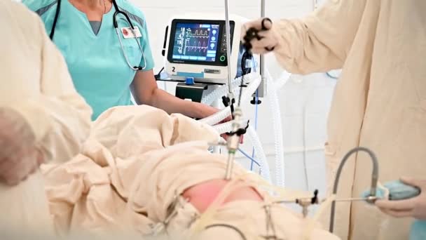 Pielęgniarka monitoruje stan pacjentów na monitorze podczas laparoskopowej operacji wyrostka robaczkowego — Wideo stockowe