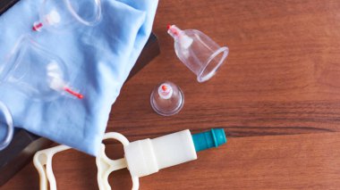 Süpürge terapisi. Bardak masajı. Hijama. Geleneksel Çin ilaç kliniği kapalı alanda. tıbbi ve sağlık konsepti.