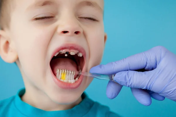 Piccolo Ragazzo Carino Lavarsi Denti Sfondo Blu — Foto Stock