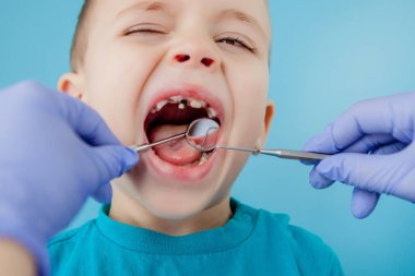 Mavi eldivenli asistanla dişçi ellerini kapatıyorlar. Çocuğa diş tedavisi uyguluyorlar. Hastanın yüzü kapalı..