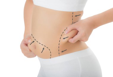 Üzerinde deri onun kalça ve göbek çizim siyah oklarla kapma kadın kapatmak, kaybetmek ağırlık ve liposuction selülit Temizleme beyaz arka plan üzerinde izole kavramı,.