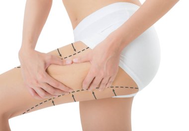 cilt üzerinde çizim siyah oklar, kilo kaybetmek ve liposuction ile onun kalça kapma kadın beyaz arka plan üzerinde izole selülit kaldırma kavramı,.