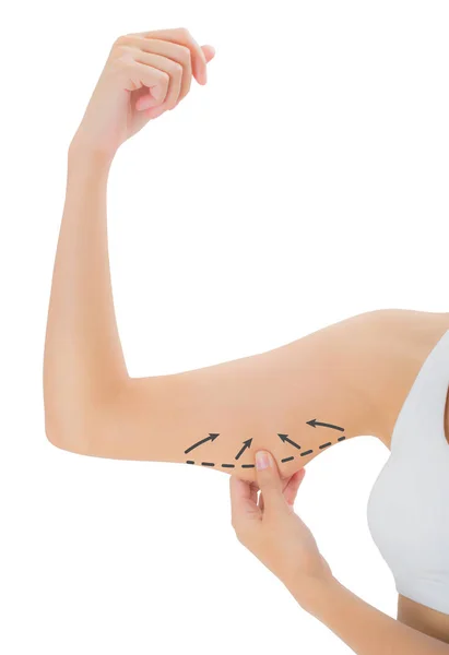 cilt üzerinde çizim siyah oklar, kilo kaybetmek ve liposuction ile üst kolu kapma kadın beyaz arka plan üzerinde izole selülit kaldırma kavramı,.