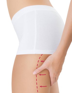 Çizim Kırmızı oklar, kilo kaybetmek ve liposuction ile arka uyluk sıkma kadın beyaz arka plan üzerinde izole selülit kaldırma kavramı,.