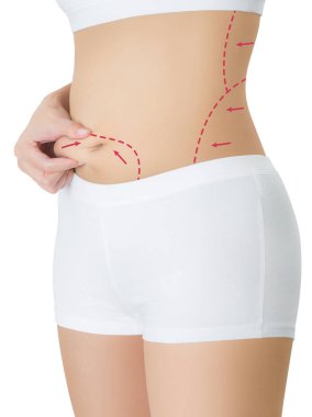 Karnı çizim Kırmızı oklar, kilo kaybetmek ve liposuction ile ciltte kapma kadın beyaz arka plan üzerinde izole selülit kaldırma kavramı,.
