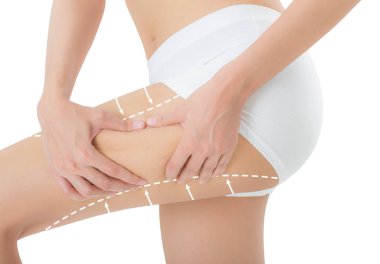 cilt üzerinde çizim beyaz ok, kilo kaybetmek ve liposuction ile onun kalça kapma kadın beyaz arka plan üzerinde izole selülit kaldırma kavramı,.