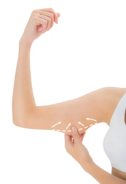 cilt üzerinde çizim oklar, kilo kaybetmek ve liposuction ile üst kolu kapma kadın beyaz arka plan üzerinde izole selülit kaldırma kavramı,.