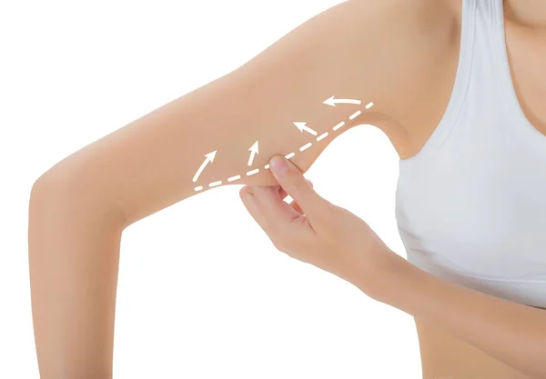 cilt üzerinde çizim oklar, kilo kaybetmek ve liposuction ile üst kolu kapma kadın beyaz arka plan üzerinde izole selülit kaldırma kavramı,.