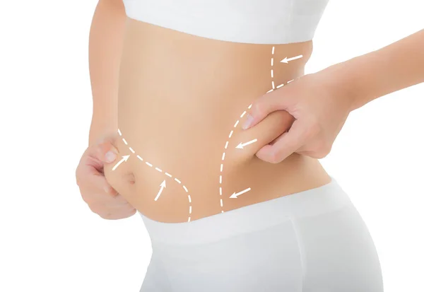 Üzerinde deri onun kalça ve göbek çizim oklarla kapma kadın kapatmak, kaybetmek ağırlık ve liposuction selülit Temizleme beyaz arka plan üzerinde izole kavramı,.